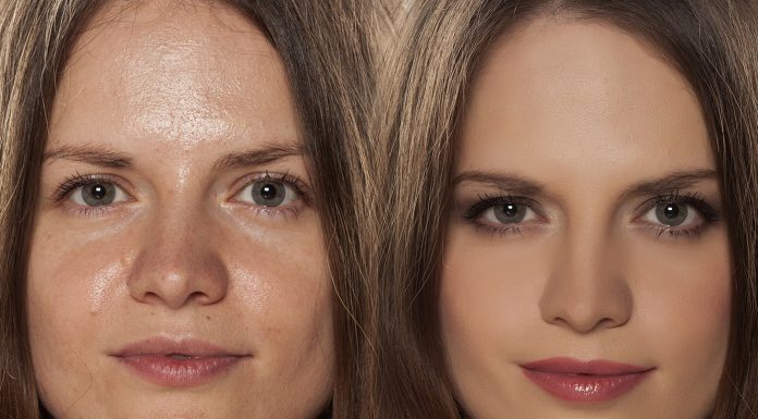 Care este cea mai buna crema hidratanta pentru ten gras?